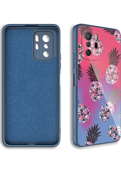 Xiaomi Redmi Note 10 Pro Kılıf Kamera Korumalı Desenli Sert Silikon Zore Epoksi Kapak NO2