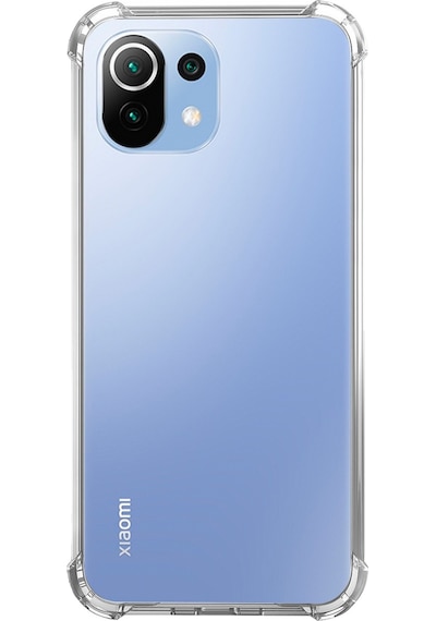 Nettech Xiaomi Mi 11 Lite Uyumlu Rarroz Seri Arka Koruma Kılıf