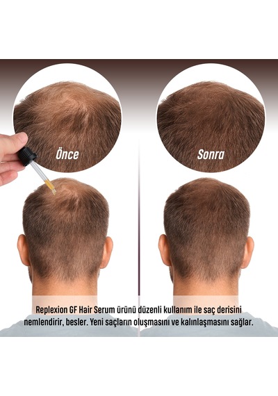 Gf Hair Replexion Saç Serumu 4 x 30 ML