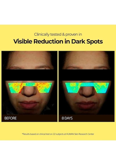 Varı Hope Varı:hope 8 Days Brıghtenıng Mask Wıth Pure Vıtamın C 1 Ad Pigmentasyona Karşı C Vit İçeren Maskesi