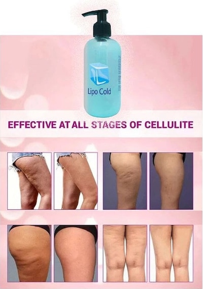 Lipo Cold Masaj Kremi 250 Ml X 1 Adet
