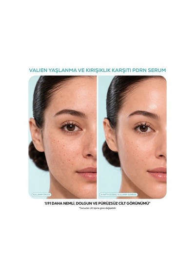 Vàlıen Yaşlanma Karşıtı Serum Somon Dna Pdrn 30 Ml