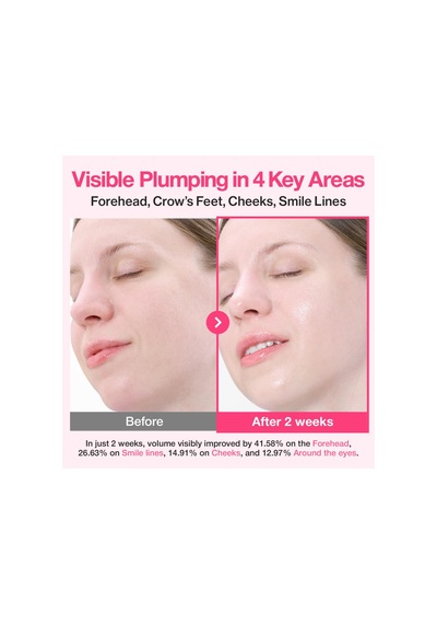 No.2 Rose Pdrn Collagen 2x Plumping Serum - %10 Gül Pdrn Ve 15 Peptitli Serum 30ml