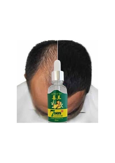 7days 7 Days 30ml Gingergerminalessentialoil Hair Growth Loss Treatment Serum Unisex 2 Adet Saç Bak