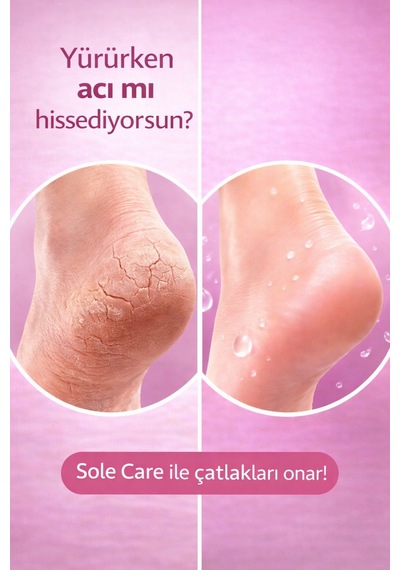 Sole Care Heel Cream Topuk Çatlak Kremi 50 ML