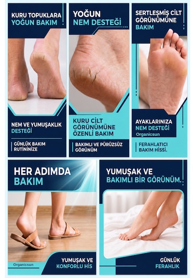 Organicsun Ayak Ve Topuk Çatlak Bakım Kremi 100ml - Ayak Kokusu, Tırnak Bakımı Avokado Ve Shea Yağlı Yoğun Nemlendirici