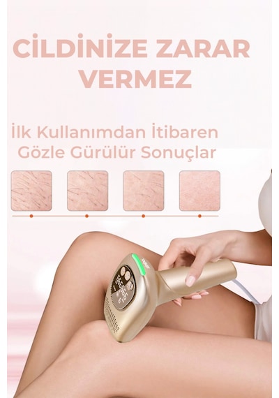 Sinbo Sel - 6044 Lazer Epilatör Gold