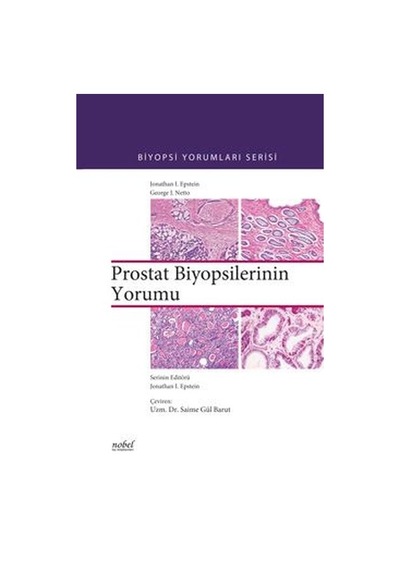 Biyopsilerin Yorumu: Prostat- Nobel Tıp Kitabevleri