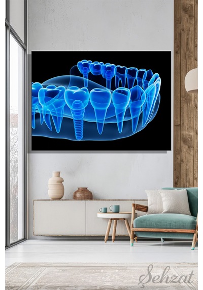 Yatay Kanvas Duvar Tablosu Ağız Diş Sağlığı Dişçi İmplant Röntgen 3d Çok Renkli