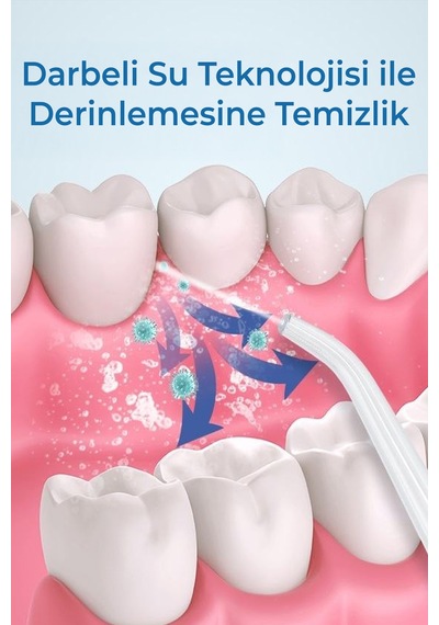 Exenar - Beyaz - Ağız Duşu Ve Diş Protez Bakım Şarjlı 3 Modlu Diş Arası Temizleyici 4 Başlıklı Taşınabilir