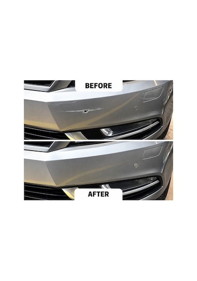 Citroen Kod Kql Motip Sprey Boya Seti (Boya+Vernik) 400ML