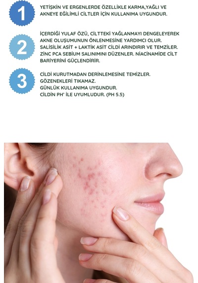 Natexia Anti-Sebium Temizleme Jeli 400 Ml