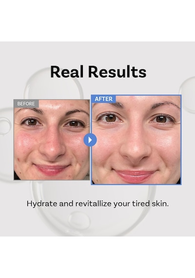 Peptide 11 Botulinum Essence Toner 250 Ml Peptitli Nemlendirici Ve Dengeleyici Tonik