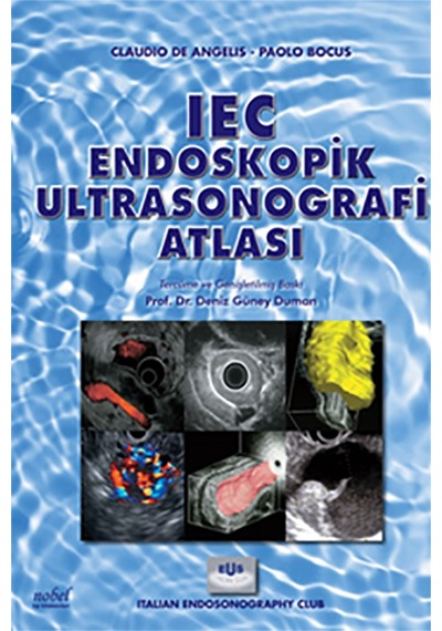 Iec Endoskopik Ultrasonografi Atlası N11.1188