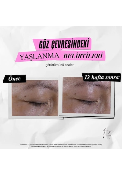Koyu Halka Ve Kaz Ayaklarını Azaltıcı Yaşlanma Karşıtı Aydınlatıcı Göz Kremi 28ml