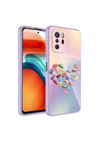 Xiaomi Redmi Note 10 Pro Kılıf Kamera Korumalı Desenli Sert Silikon Zore Epoksi Kapak NO1