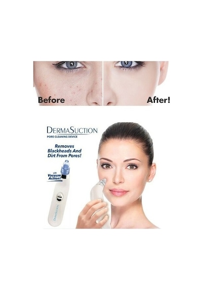 Derma Suction Vakumlu Siyah Nokta ve Yüz Temizleme Cihazı