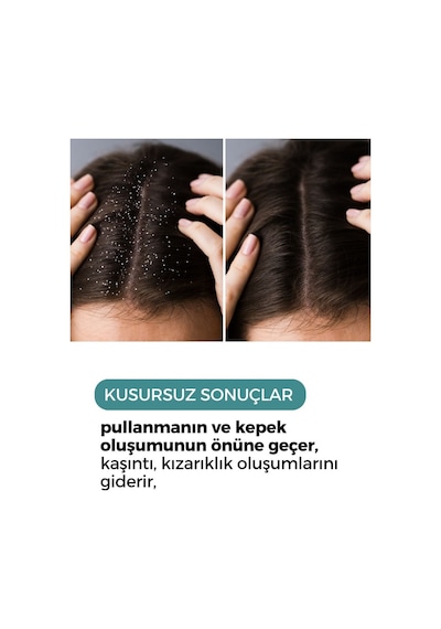 Zento Hair Scalp AntıiDandruff Kepek Şampuanı 250 ML