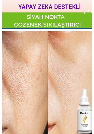 Retinol + Gözenek Ve Siyah Nokta Önleyici 2'li Bakım Seti