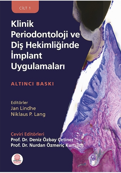 Klinik Periodontoloji Ve Diş Hekimliğinde İmplant Uygulamaları