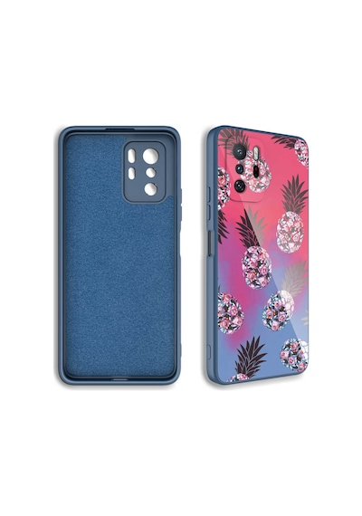 Zore Redmi Note 10 Pro Kılıf Kamera Korumalı Desenli Sert Silikon Nvth Epoksi Kapak - No2