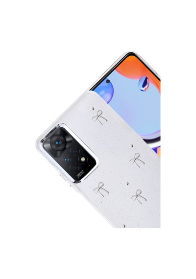 Newface - 256 - Xiaomi Redmi Note 11 Pro Fiyonk Desenli Kapak - - Spt-gld - Desen 5 Diğer