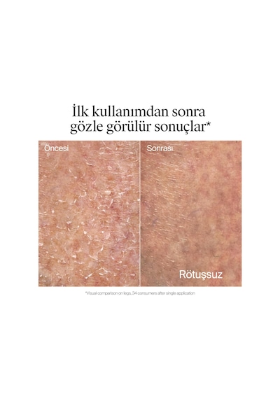 Onarıcı Bakım Cıca Vücut Losyonu 400 Ml Çok Kuru Sert Ciltler İçin Pantenol Ve Allantoin İçerir