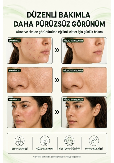 Organicsun Çay Ağacı Ve Propolisli Akne Ve Sivilce Karşıtı Cilt Bakım Kremi Siyah Nokta Ve Leke Görünümü Bakımı 50 Ml