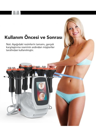 Zeelux Profesyonel 80k Ultrasonik Kavitasyon & Vakum Rf Masaj Cihazı - 5'i 1 Arada Vücut Şekillendirme Ve Cilt Sıkılaştırma