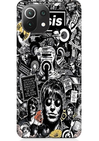 Xiaomi Mi 11 Lite Uyumlu Oasis Poster Desenli Silikon Kılıf