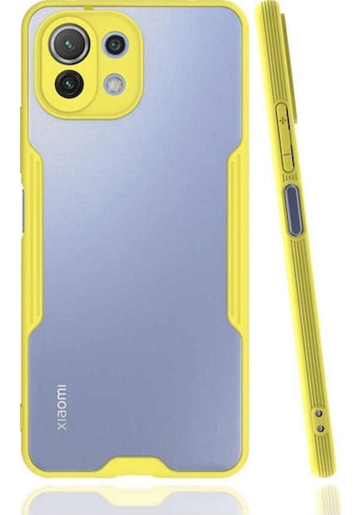 Xiaomi Mi 11 Lite Kilif Kamera Korumali Colorful Kapak 502111114