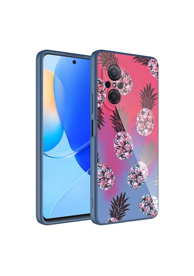 Ariatech Huawei Nova 9 Se Kılıf Kamera Korumalı Desenli Sert Silikon Epoksi Kapak - N NO3