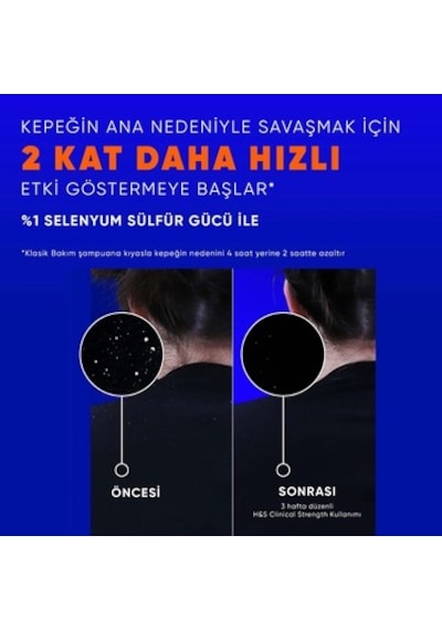Kuru Saç Derisine Özel Şampuan - 350 Ml Derin Temizlik Normal
