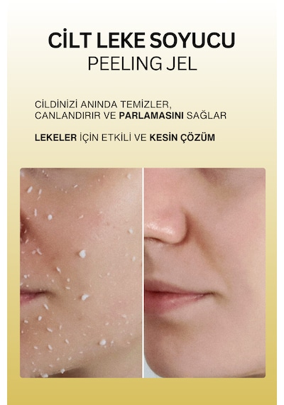 Dr. Wsay Leke Soyucu Peeling Jel 100 ML