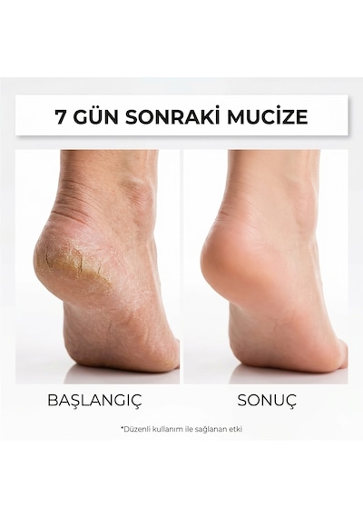 Dr. Bronos Bitkisel Ayak Bakım Kremi 150 ML