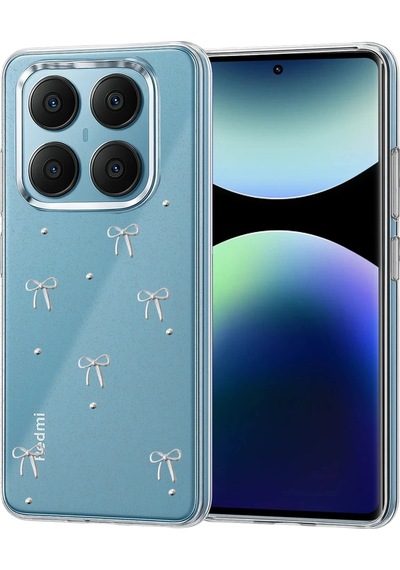 Durukar Redmi Note 14 Pro 4g Fiyonk Desenli Kapak - Desen 1
