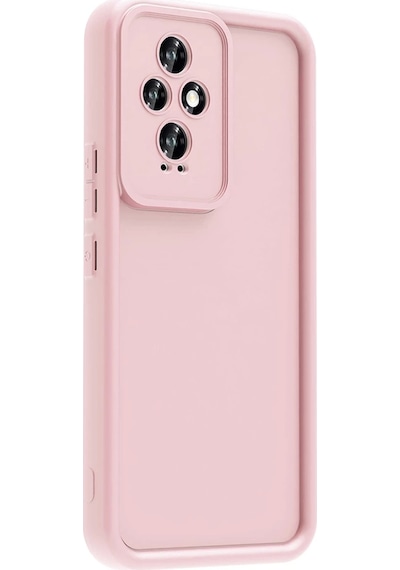 Honor 200 Kılıf Kamera Korumalı Zore Ananas Kapak