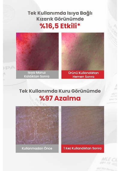 Atopik Ciltlere Özel Cilt Bariyerini Destekleyen Yoğun Nemlendirici Krem Atopalm Mle Cream 100 Ml