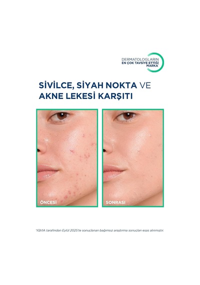 Lexroo Sebium Kerato+ Cover Sivilce, Karşıtı Renkli Nemlendirici Krem 30 Ml