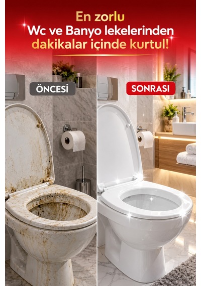 Ultra Konsantre Wc Ve Banyo Temizleme Spreyi Güçlü Formül Kireç Sabun Artığı Ve Kir Temizleyici 450 Ml Diğer