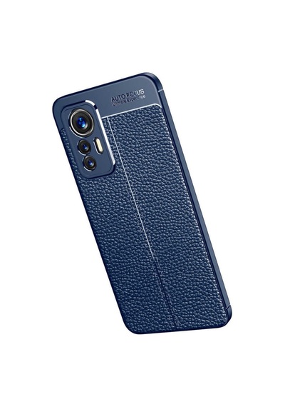 Xiaomi Mi 12 Lite Kilif Zore Niss Deri Desenli Silikon Kilif 559808065