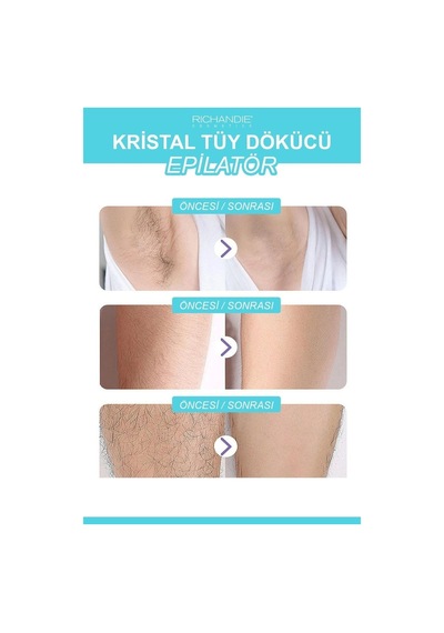 Crystal Eraser Epilasyon Aleti Tüy Silgisi Tüy Alıcı Fiziksel Kristal Tüy Dökücü Epilatör Mavi