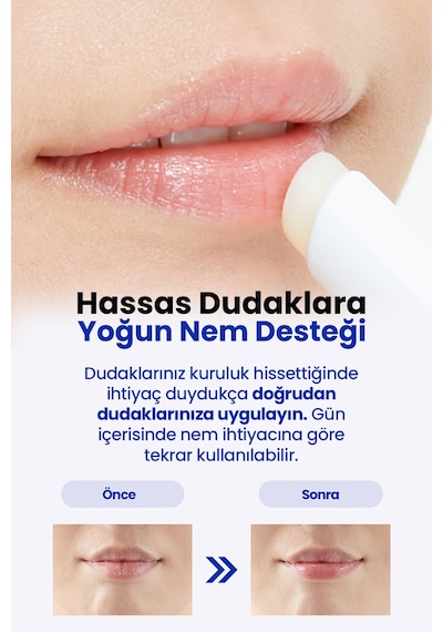 Hassas Cilt Bariyerine Bakım Yapan Nemlendirici Dudak Balmı Realbarrıer Extreme Moisture Lip Balm
