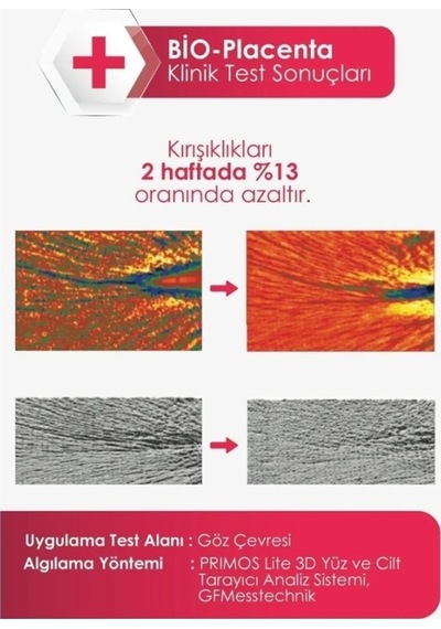 Veela Yaşlanma Belirtilerine Karşı Göz Çevresi Serumu