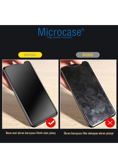 Microcase Oneplus 15 Global İle Uyumlu Tpu Nano Mat Ekran Koruma Filmi Ekm107