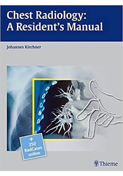 Chest Radiology