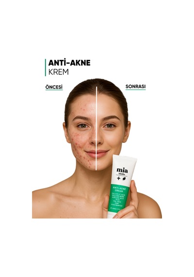 Mia Klinika Akneli Sivilceli ve Yağlı Ciltler İçin Bariyer Güçlendirici Nemlendirici Krem 50 ML