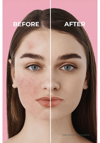 Sinoz Pink Touch Yüksek Koruyucu Ton Eşitleyici Pembe Yüz Güneş Kremi SPF50+ 50 ML