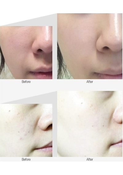 Medipeel Peptide-tox Bor Ampoule 30 Ml Kırışıklıkl Karşıtı . Etkili Yüz Serumu M0520