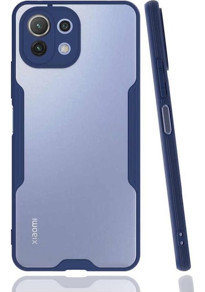Xiaomi Mi 11 Lite Kilif Kamera Korumali Colorful Kapak 502111114